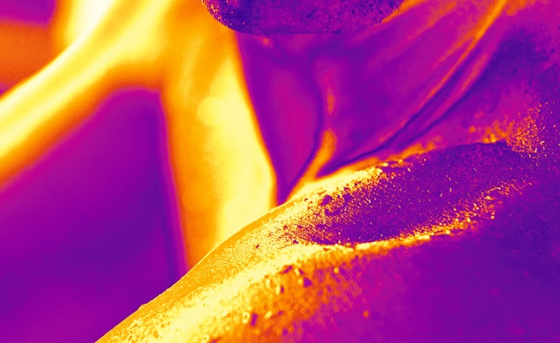 Thermal heat map of skin under UV