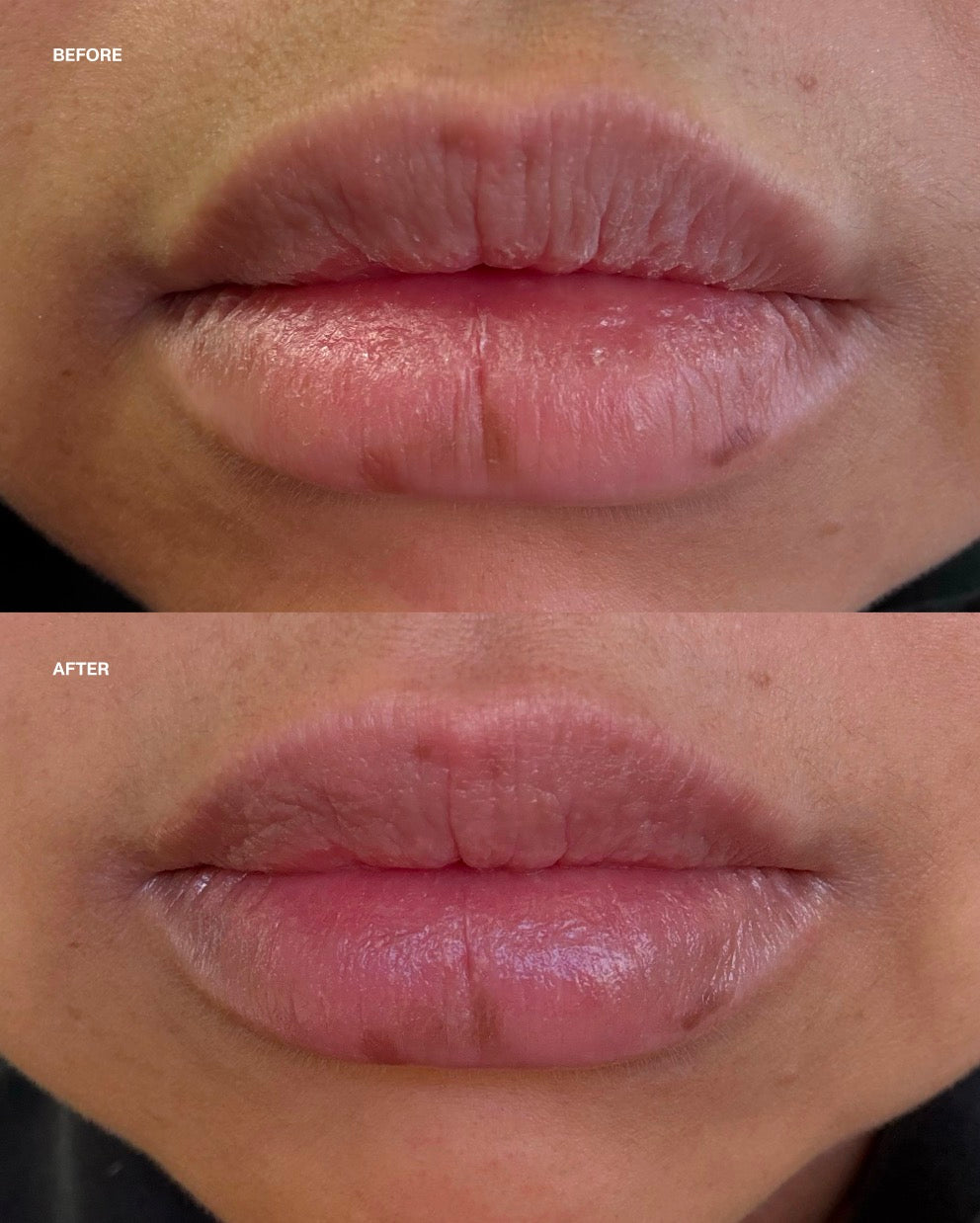 Everyday Lip Balm