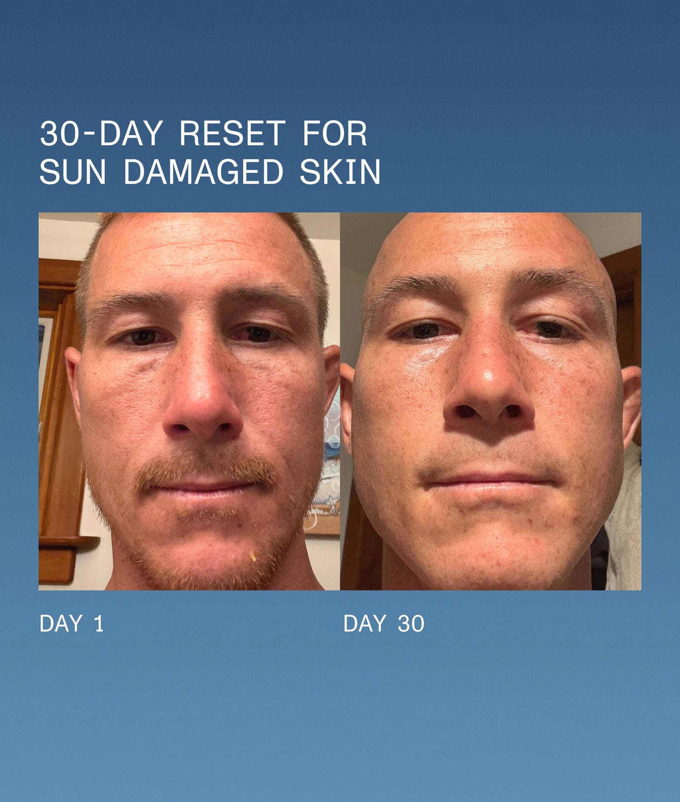 Everyday