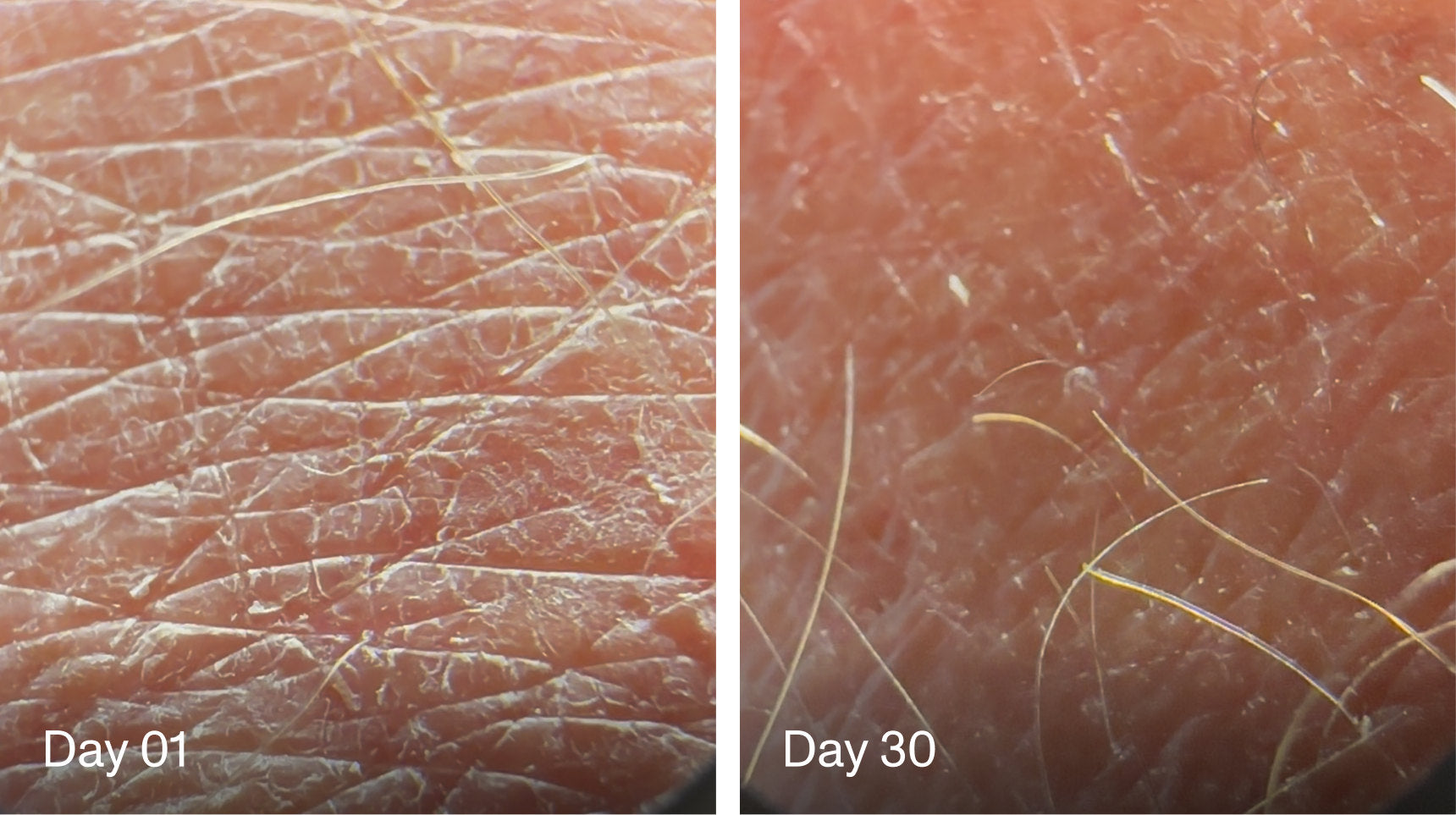 Macro comparison of the same skin at day 1 and day 30