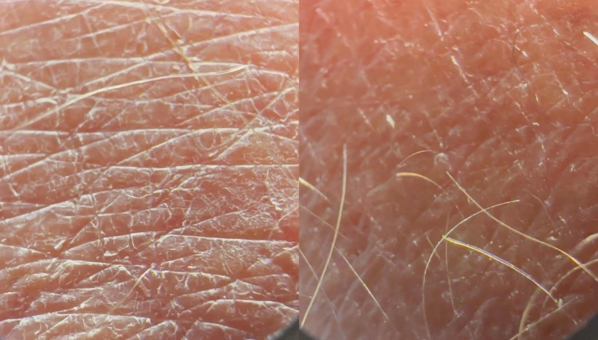 Macro comparison of skin texture